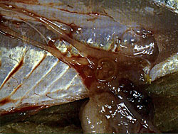 Roundworms