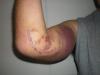 post-27207-130162929312_thumb.jpg