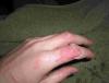 post-36100-0-40423900-1334171905_thumb.j
