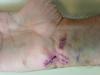 post-49466-0-86400400-1434392773_thumb.j