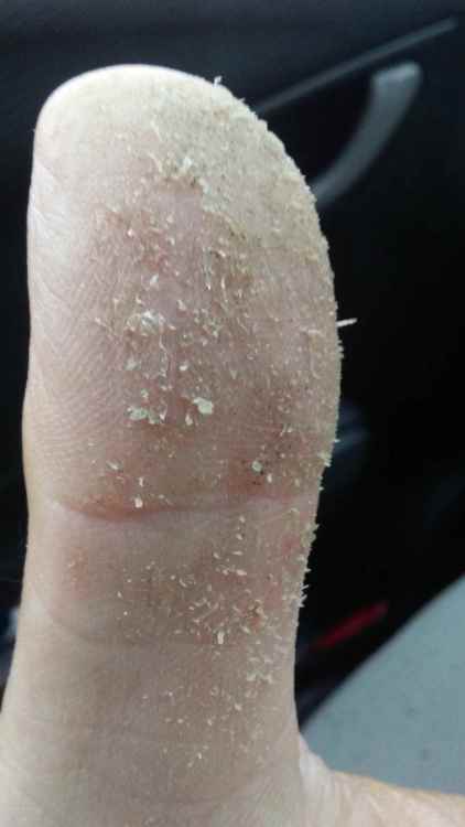 thumb.jpg