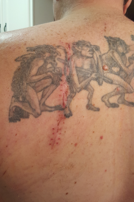 scar.PNG.45dc76187b5d37830b2f993cde64e639.PNG
